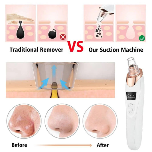 Blackhead Remover Face Acne Black Dot Pimple Electric Black head Vacuum Cleaner Pore Skin Care Tools Machine 4 Replacement Head (random color)