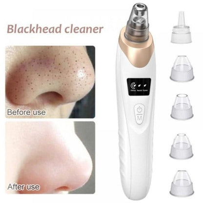 Blackhead Remover Face Acne Black Dot Pimple Electric Black head Vacuum Cleaner Pore Skin Care Tools Machine 4 Replacement Head (random color)